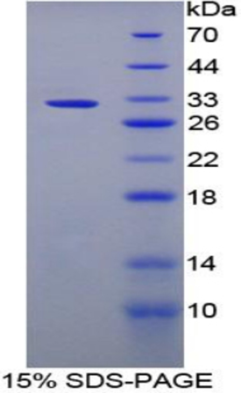 Rabbit Recombinant Lipopolysaccharide Binding Protein (LBP)