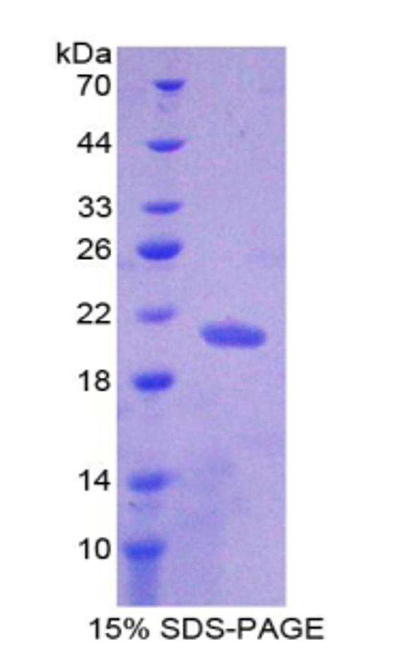 Human Recombinant Nucleoporin 210kDa (NUP210)