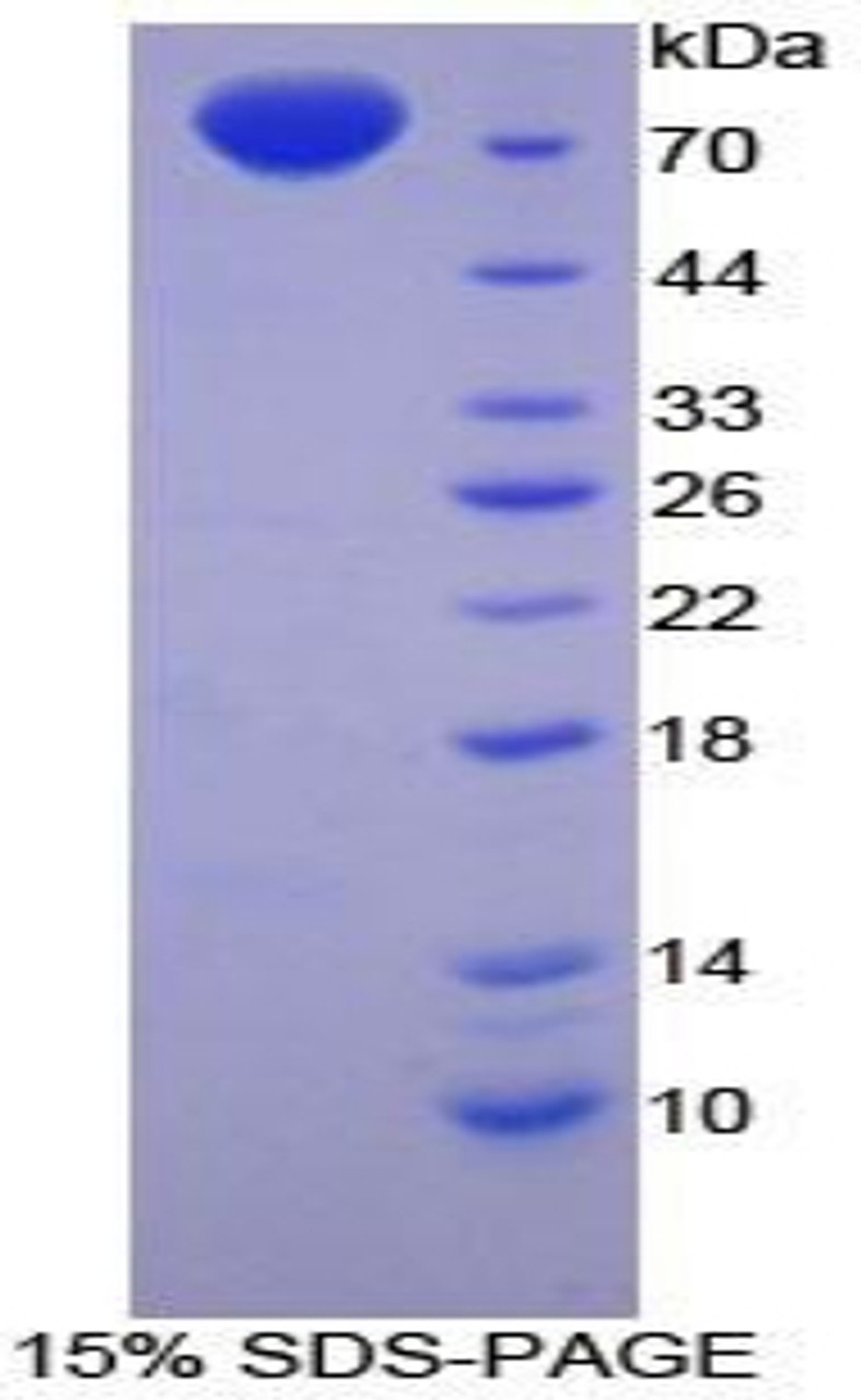 Chicken Recombinant Enolase, Muscle Specific (MSE)