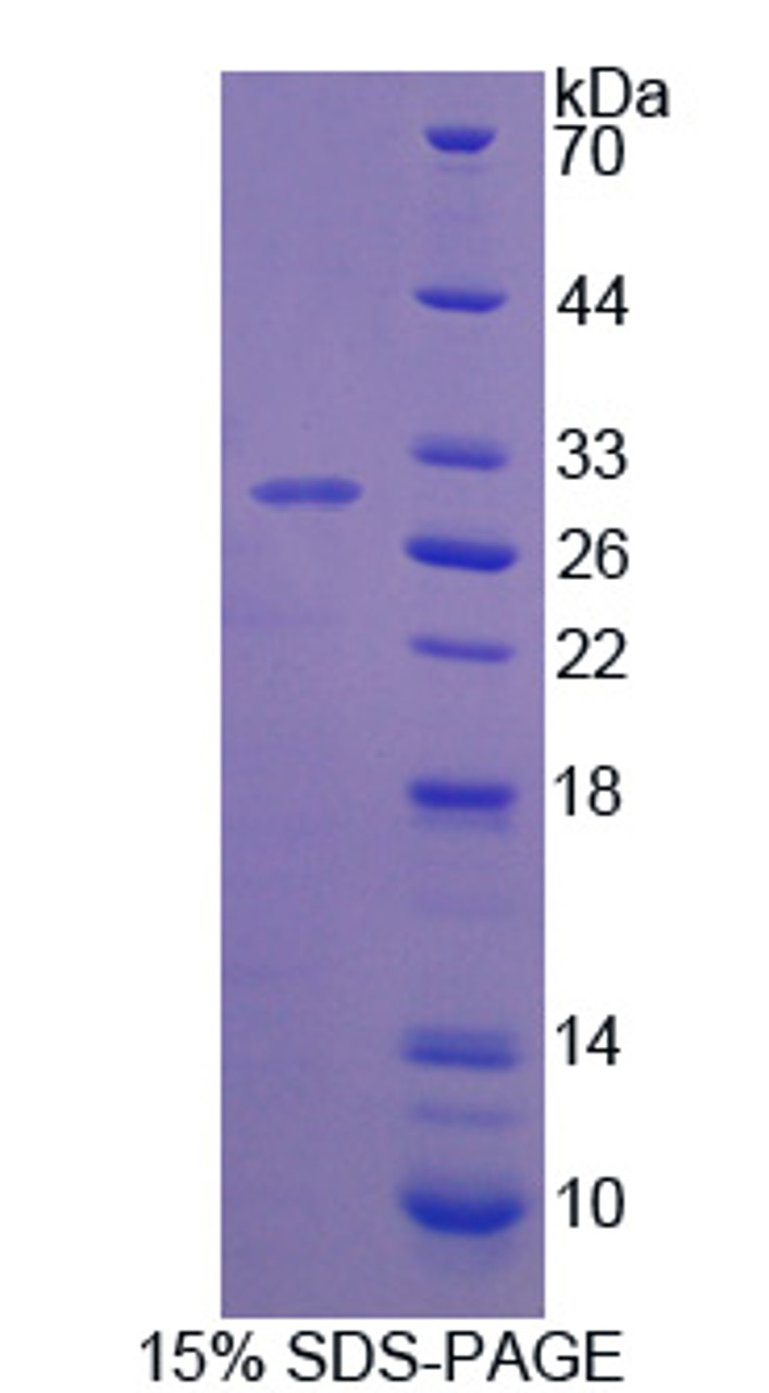 Human Recombinant Tyrosine Hydroxylase (TH)