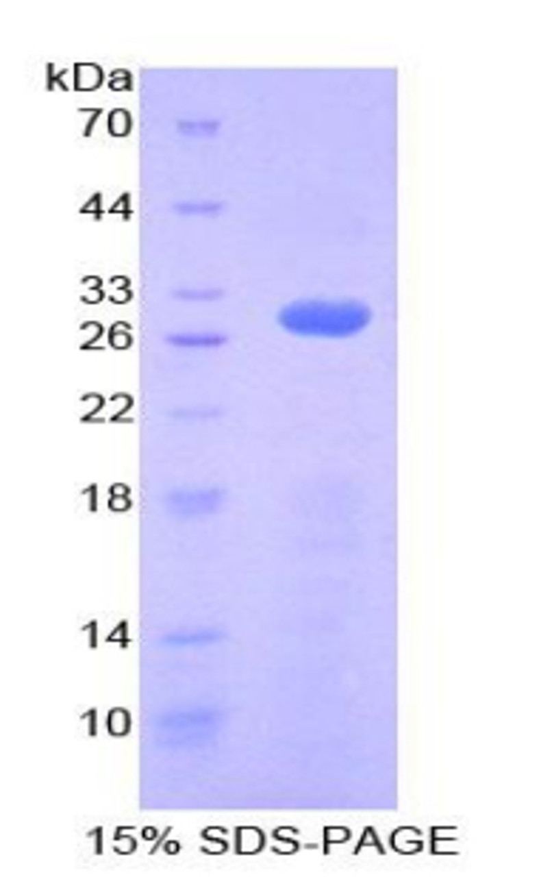 Human Recombinant Ribonuclease Inhibitor (RI)