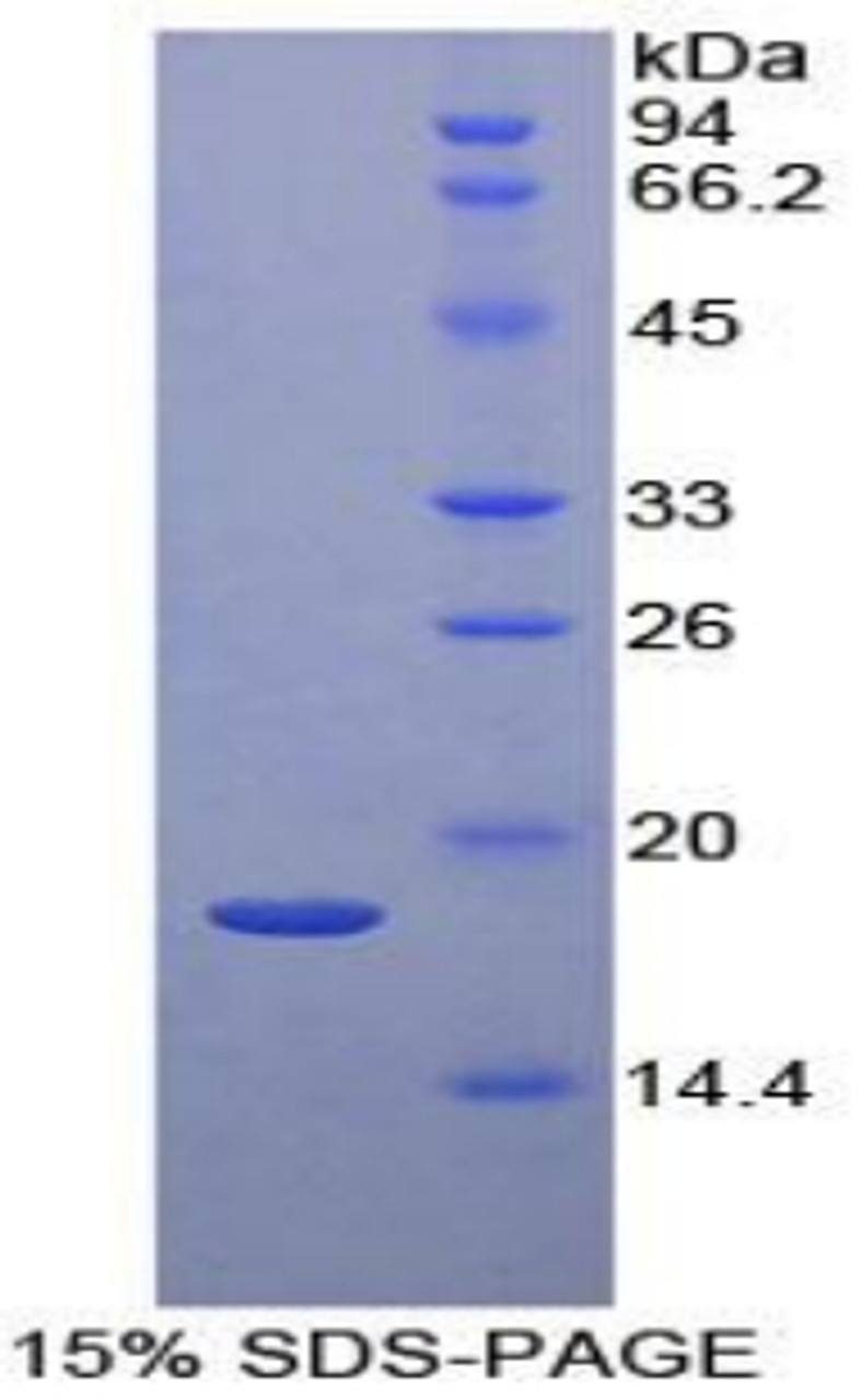 Human Recombinant Mitogen Activated Protein Kinase Scaffold Protein 1 (MAPKSP1)