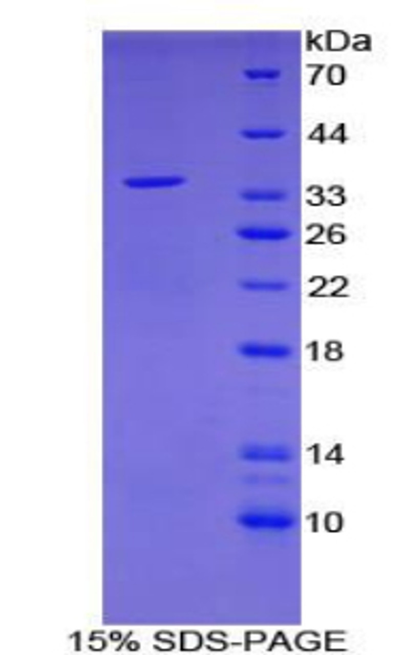 Human Recombinant Early Growth Response Protein 3 (EGR3)