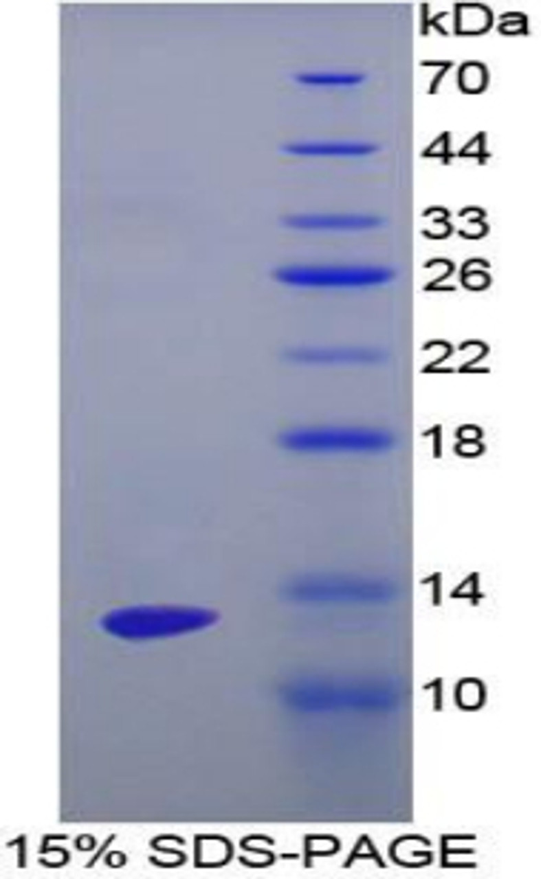 Human Recombinant Enolase, Non Neuronal (NNE)