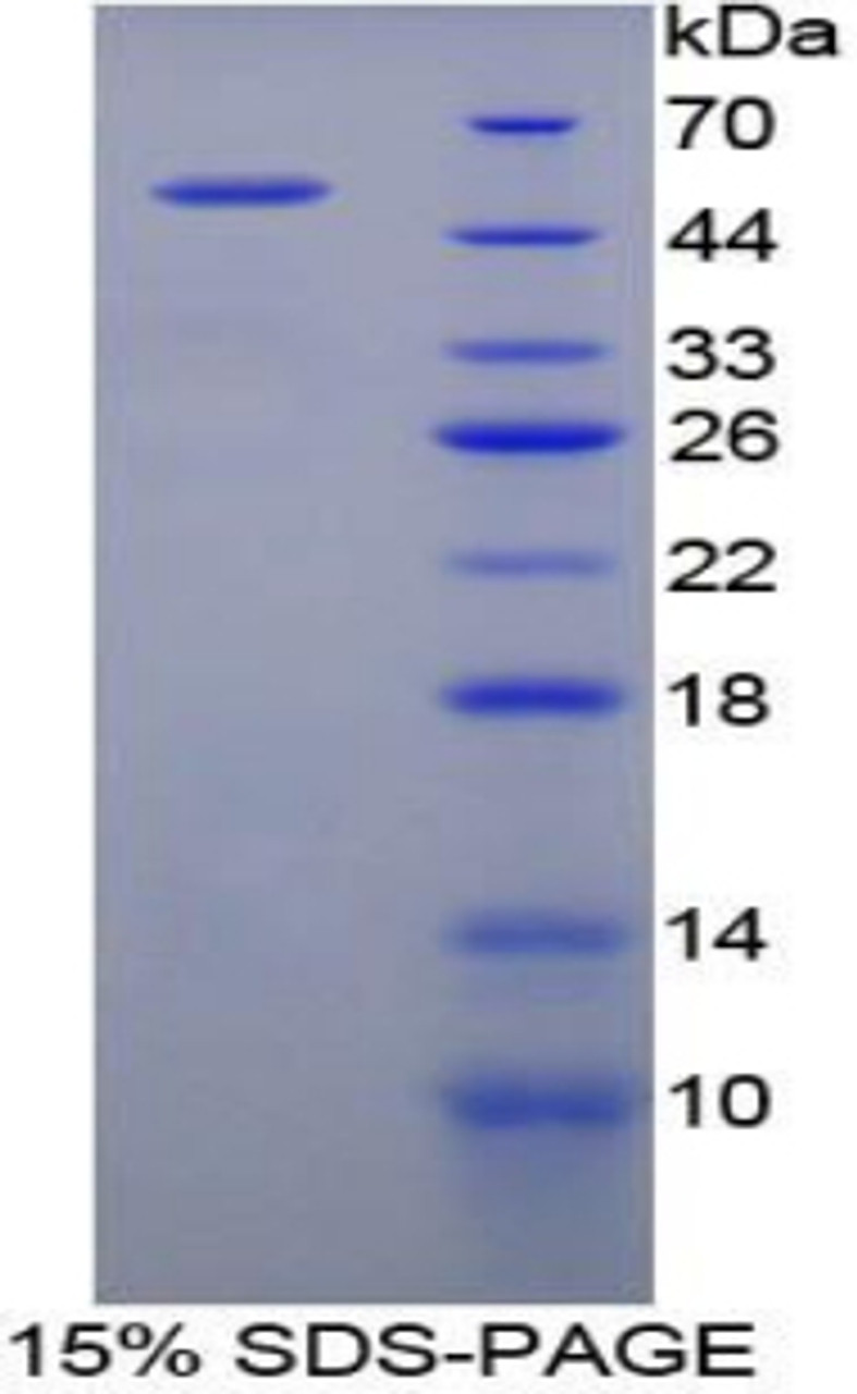 Human Recombinant Enolase, Non Neuronal (NNE)