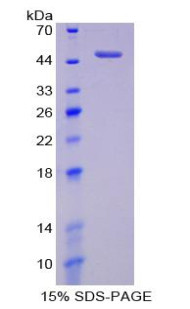 Mouse Recombinant Enolase, Non Neuronal (NNE)