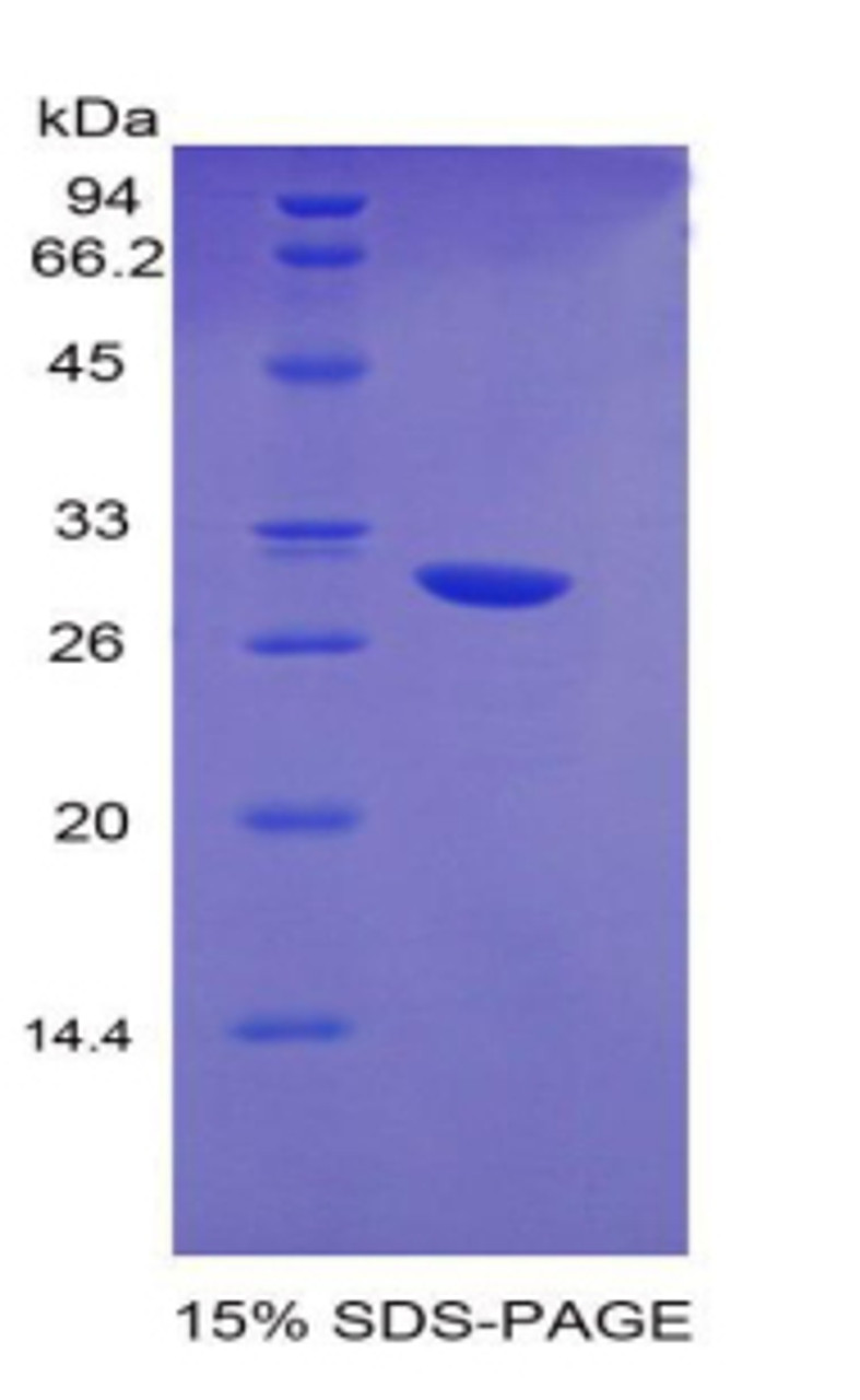 Mouse Recombinant Early Growth Response Protein 2 (EGR2)