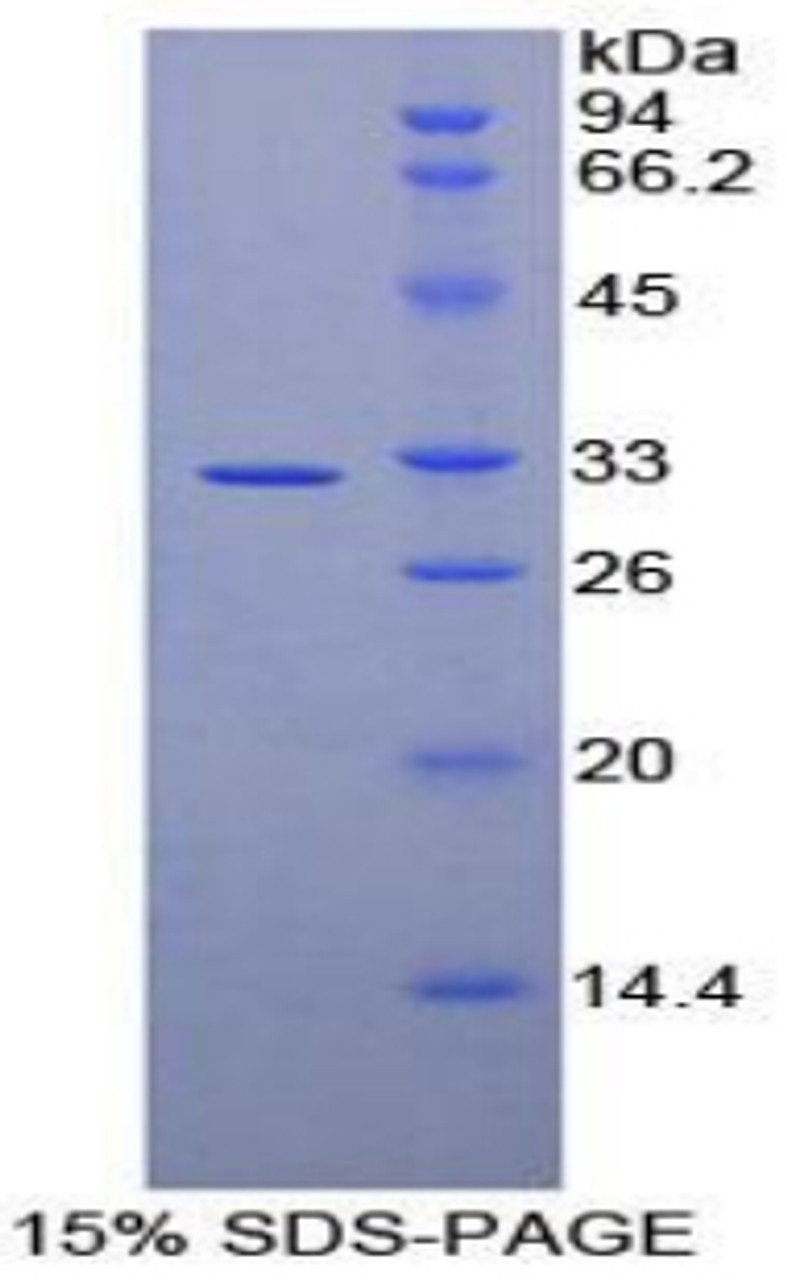 Human Recombinant Amylase Alpha 2, Pancreatic (AMY2)