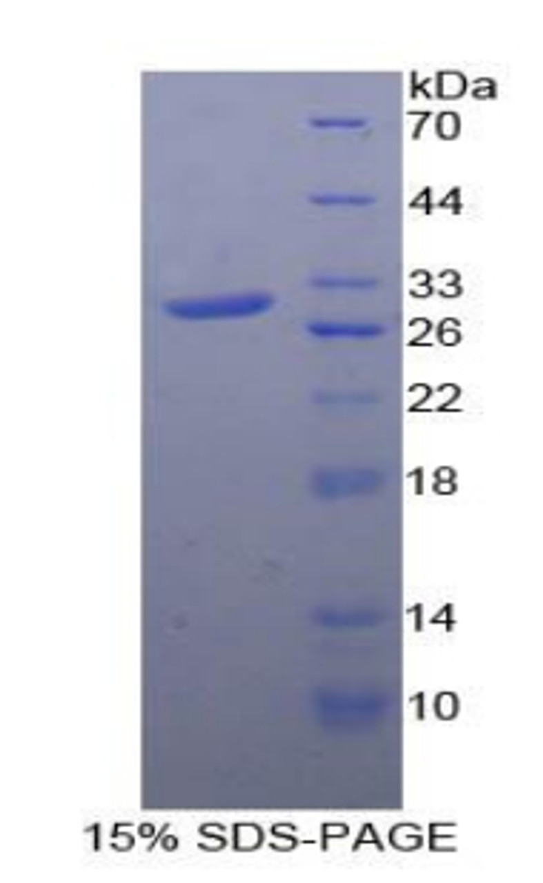 Human Recombinant Mitogen Activated Protein Kinase Activated Protein Kinase 2 (MAPKAPK2)