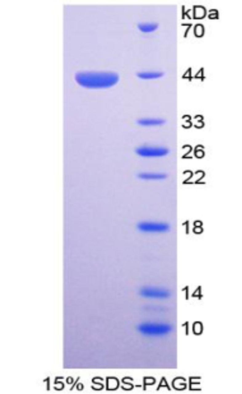 Cattle Recombinant Matrix Gla Protein (MGP)