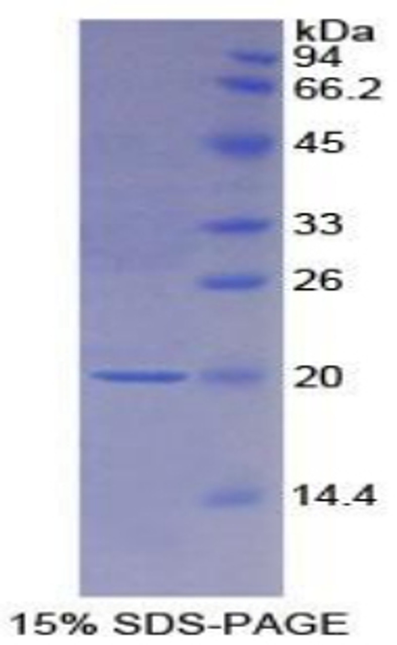 Rat Recombinant Colony Stimulating Factor Receptor, Macrophage (MCSFR)