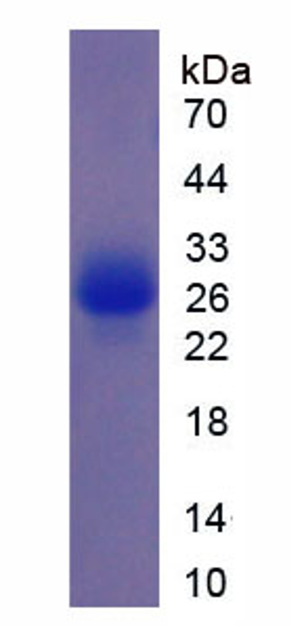 Mouse Recombinant Ornithine Carbamoyl Transferase (OCT)