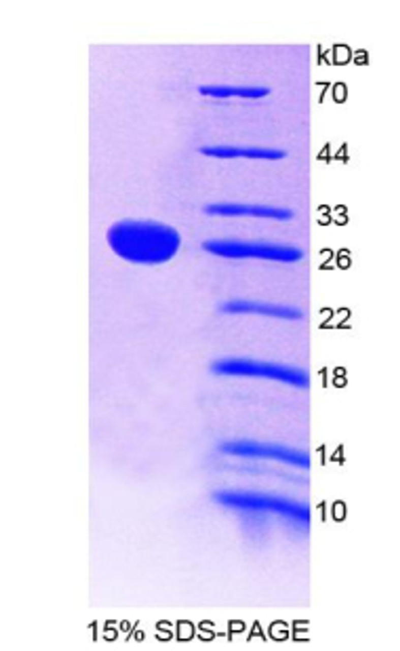 Rat Recombinant Tumor Necrosis Factor Receptor Superfamily, Member 1B (TNFRSF1B)