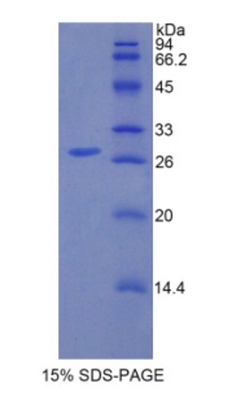 Human Recombinant Interleukin 1 Receptor Associated Kinase 1 (IRAK1)