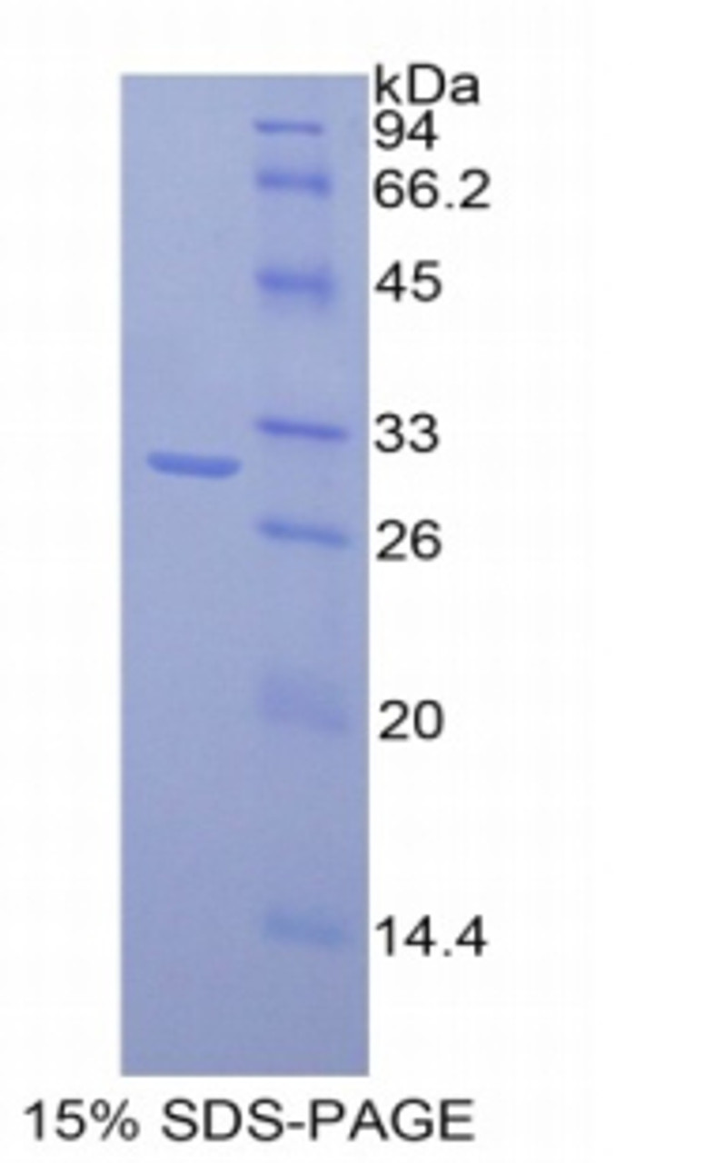 Mouse Recombinant Mucosal Addressin Cell Adhesion Molecule 1 (MAdCAM1)