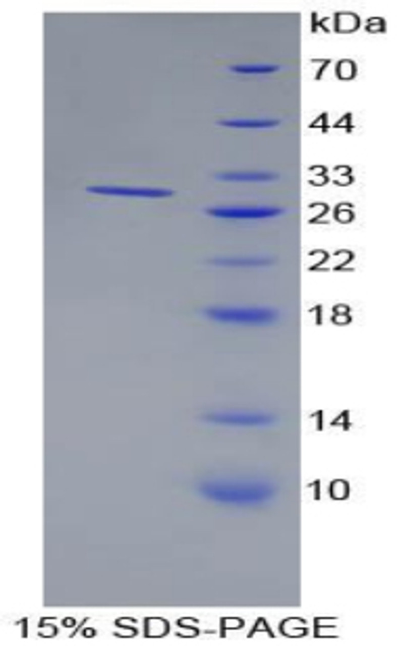 Human Recombinant Bone Marrow Stromal Cell Antigen 1 (BST1)