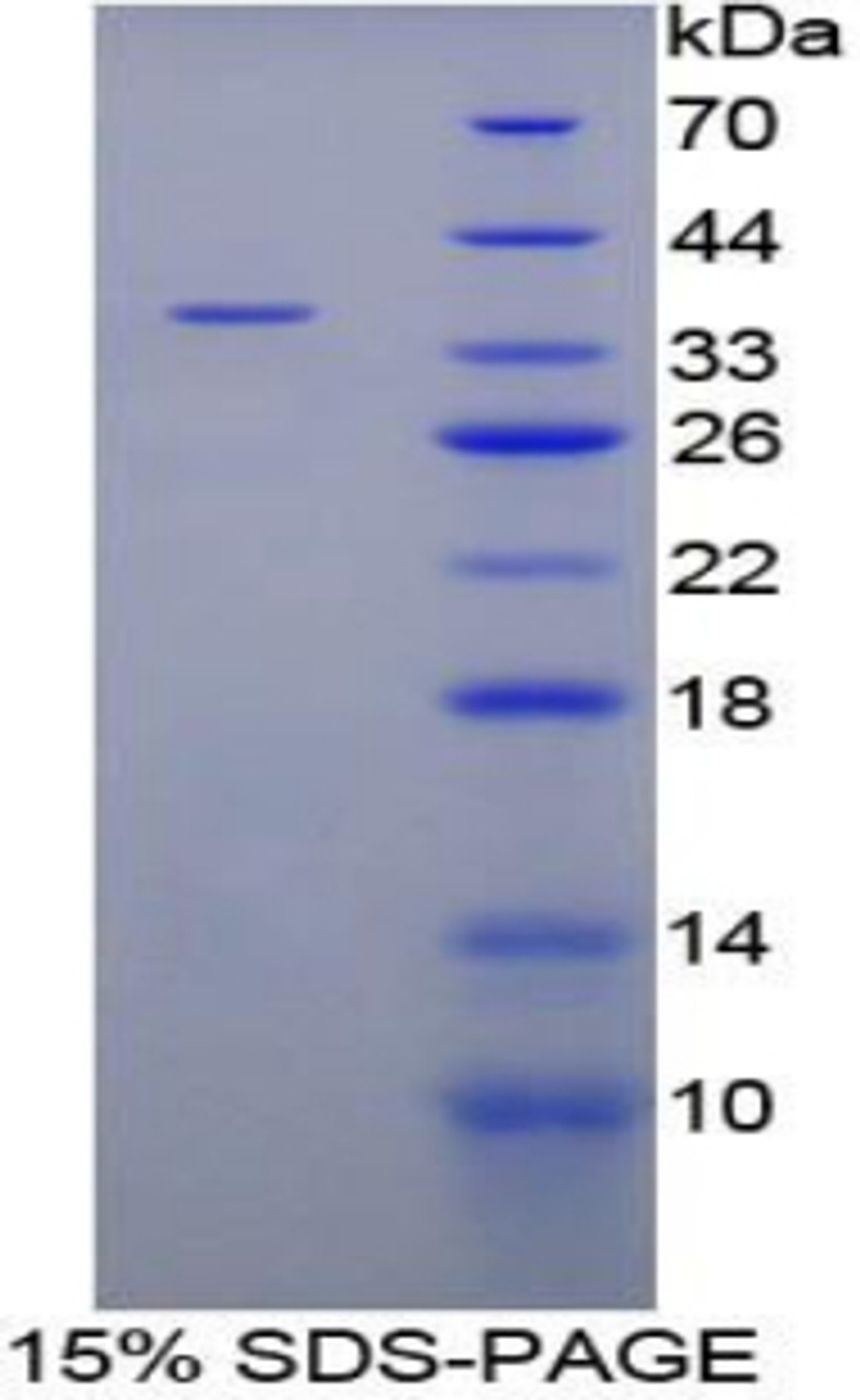 Human Recombinant Cytochrome P450 21B (CYP21B)