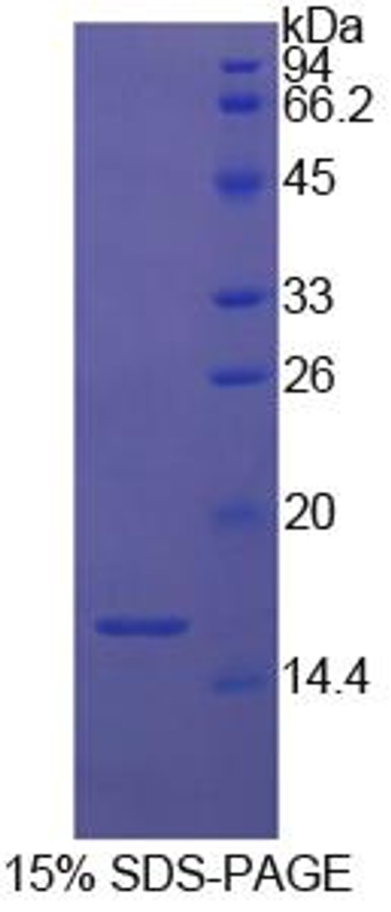 Cattle Recombinant Fatty Acid Binding Protein 1, Liver (FABP1)