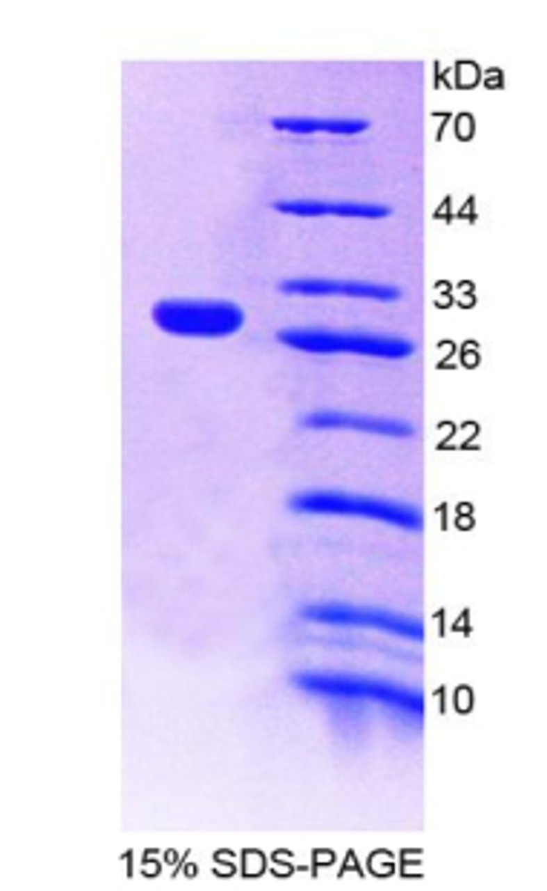 Mouse Recombinant Intercellular Adhesion Molecule 4 (ICAM4)