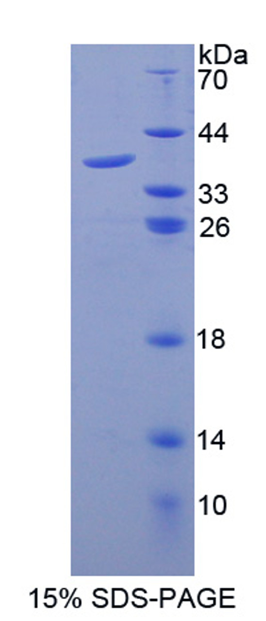 Cattle Recombinant Granulocyte Chemotactic Protein 2 (GCP2)
