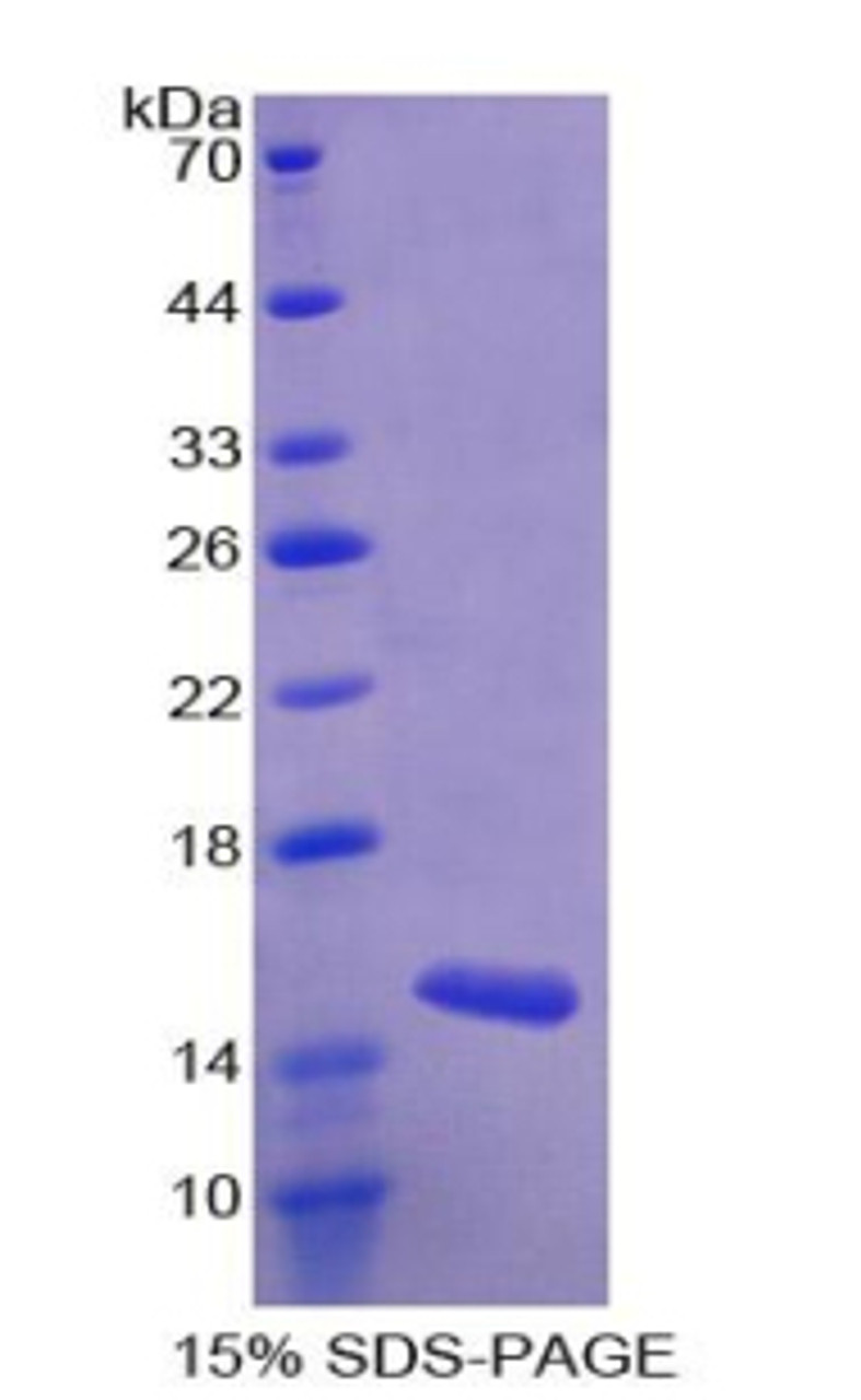 Human Recombinant Mucosae Associated Epithelia Chemokine (MEC)