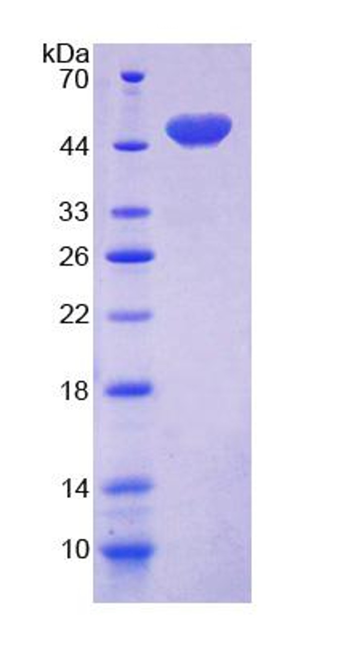 Human Recombinant Cluster Of Differentiation 164 (CD164)