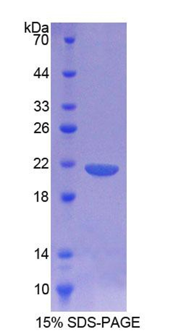 Rat Recombinant Cluster Of Differentiation 164 (CD164)