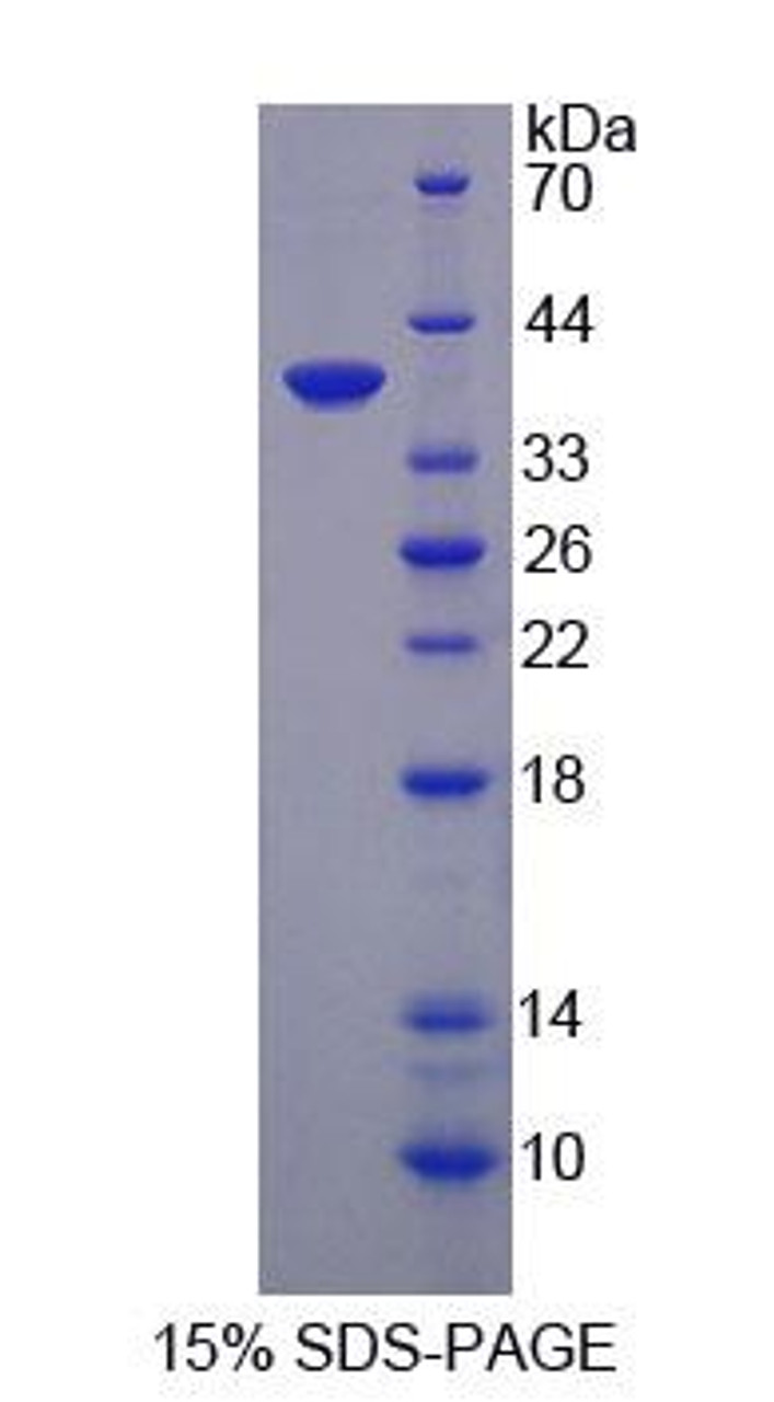 Rat Recombinant Growth Regulated Oncogene Gamma (GROg)