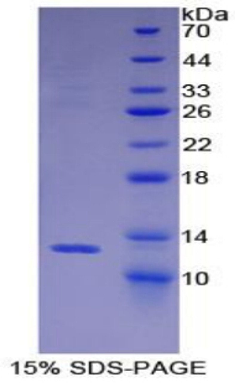 Mouse Recombinant Breast And Kidney Expressed Chemokine (BRAK)