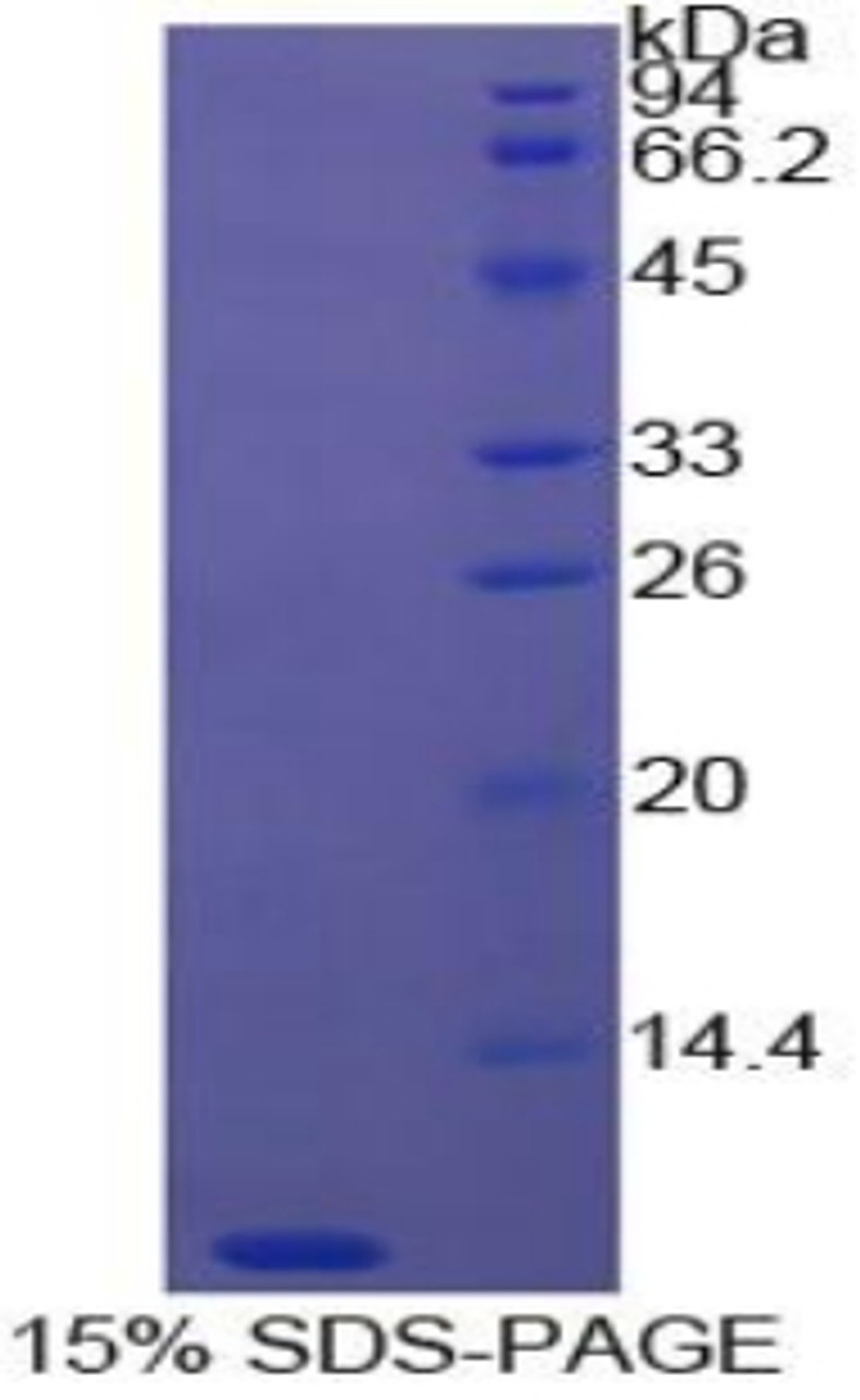 Cattle Recombinant Thymosin Beta 4 (Tb4)