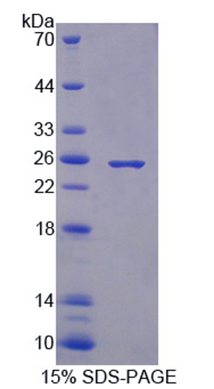 Mouse Recombinant Coagulation Factor XIII B Polypeptide (F13B)