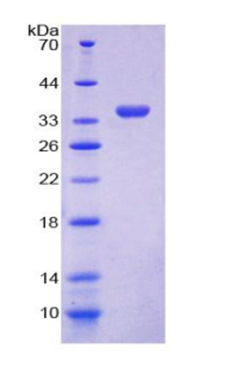 Human Recombinant GDP Dissociation Inhibitor 1 (GDI1)