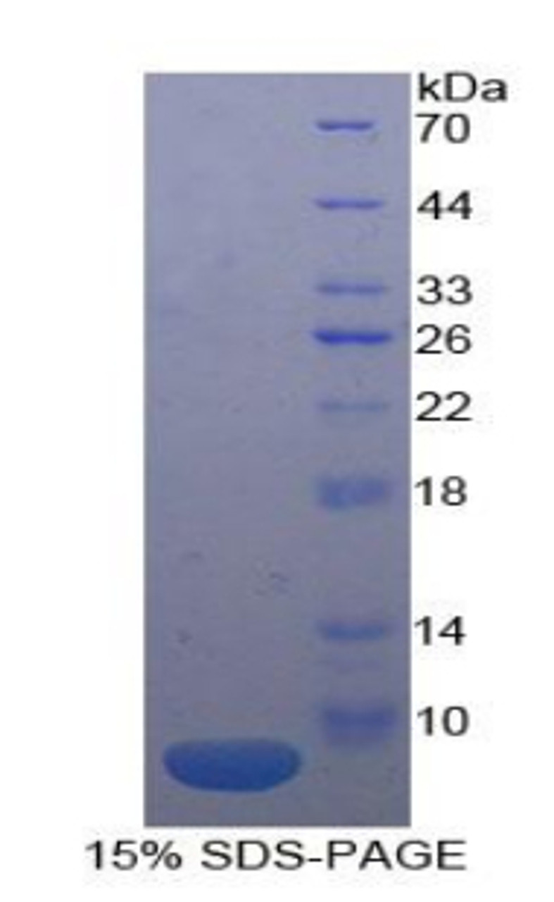 Human Recombinant Interleukin 18 Receptor 1 (IL18R1)