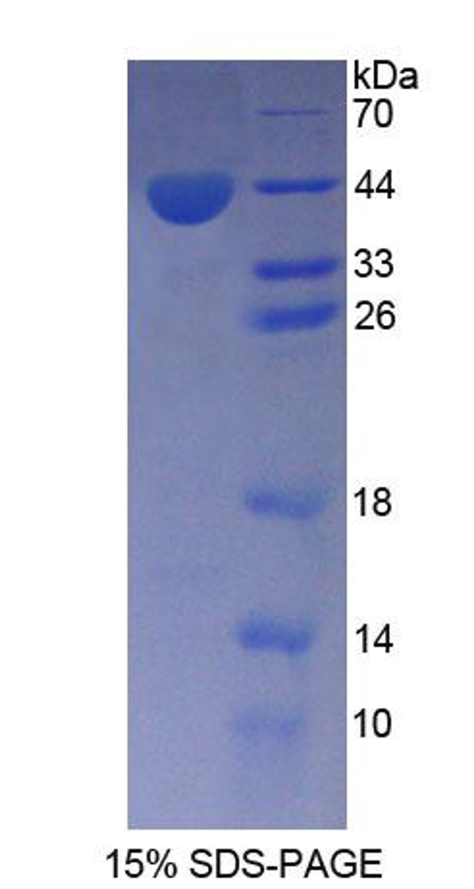 Rat Recombinant Angiotensin II Receptor 1 (AGTR1)