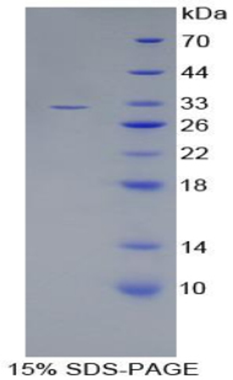 Human Recombinant Complement Component 1, S Subcomponent (C1s)