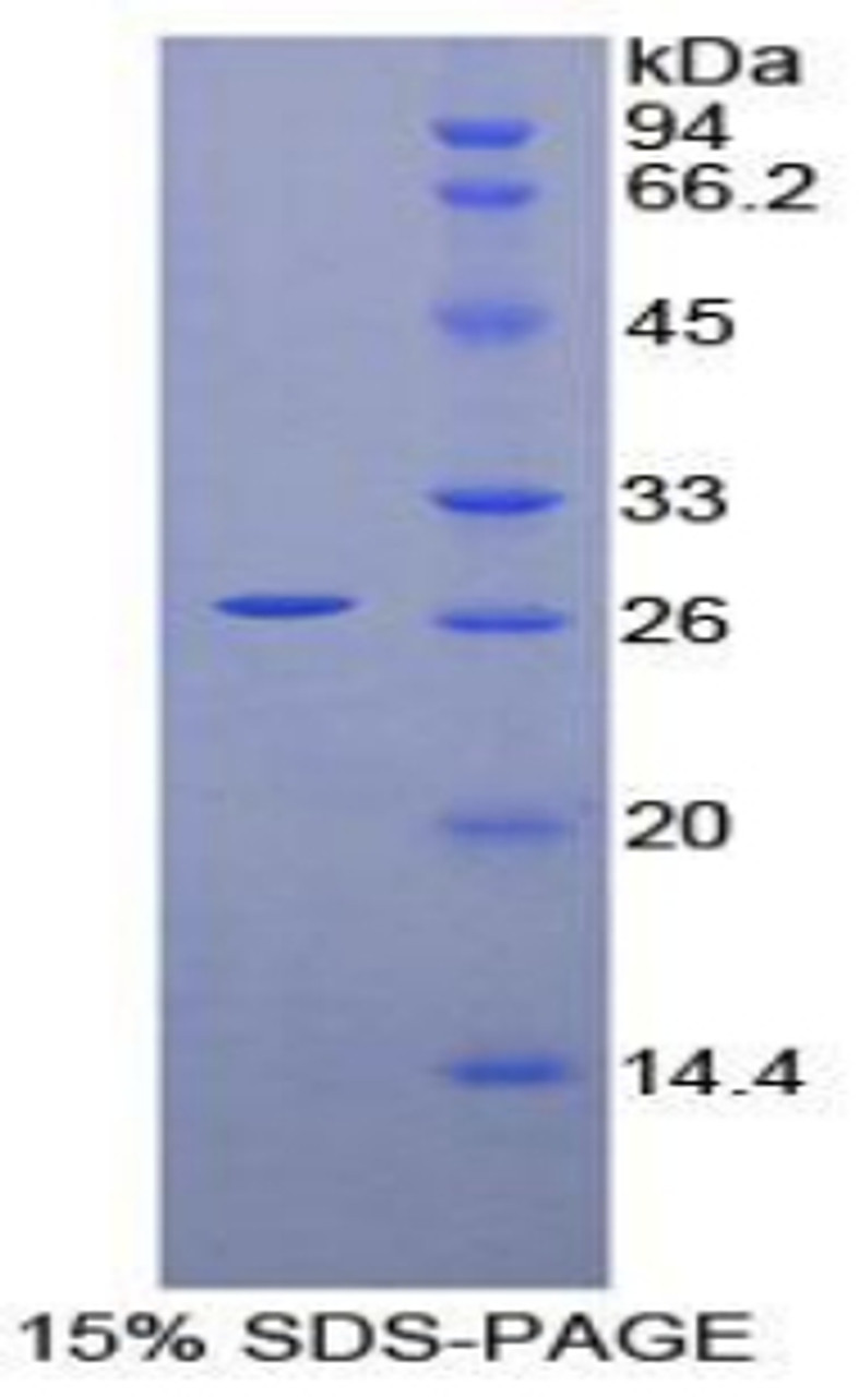Mouse Recombinant Prion Protein (PRNP)