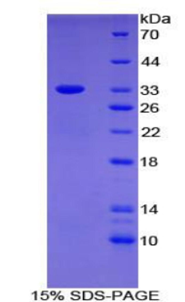 Human Recombinant Anion Exchange Protein 1 (AE1)