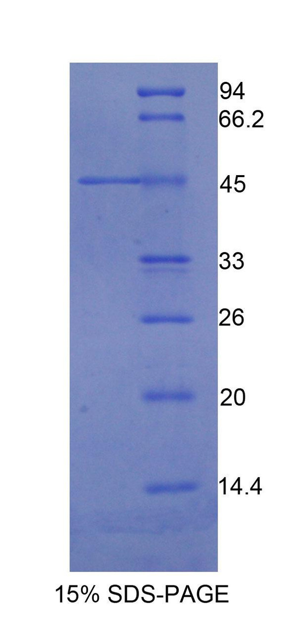 Human Recombinant Integrin Alpha M (ITGaM)