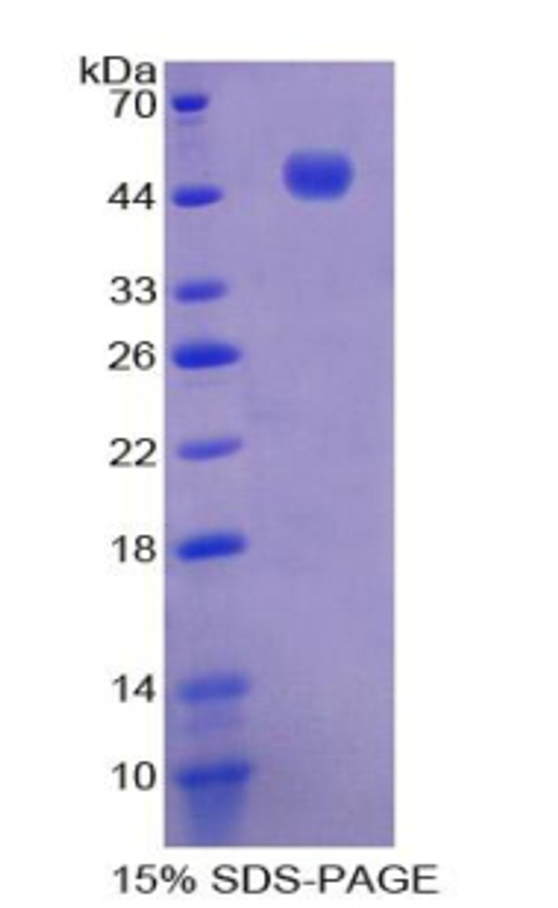 Mouse Recombinant Interleukin 21 (IL21)