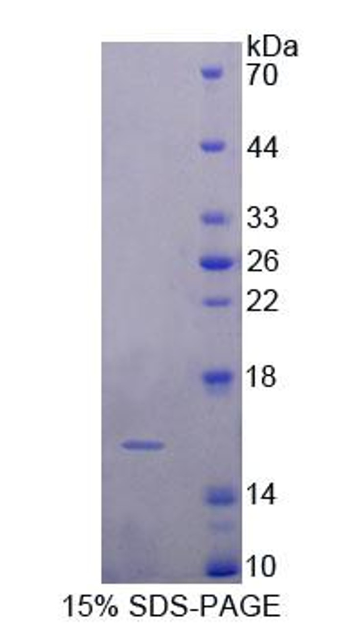 Human Recombinant Fatty Acid Binding Protein 4, Adipocyte (FABP4)