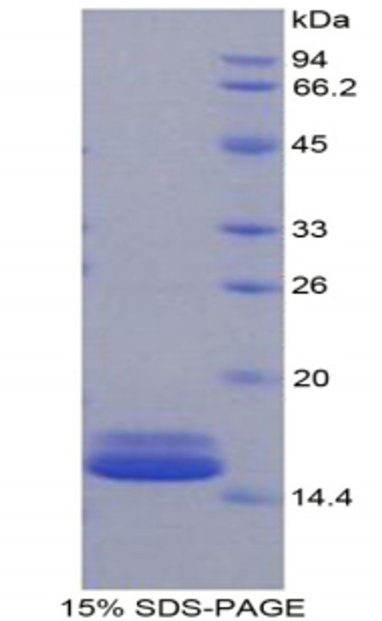 Mouse Recombinant Fatty Acid Binding Protein 4, Adipocyte (FABP4)