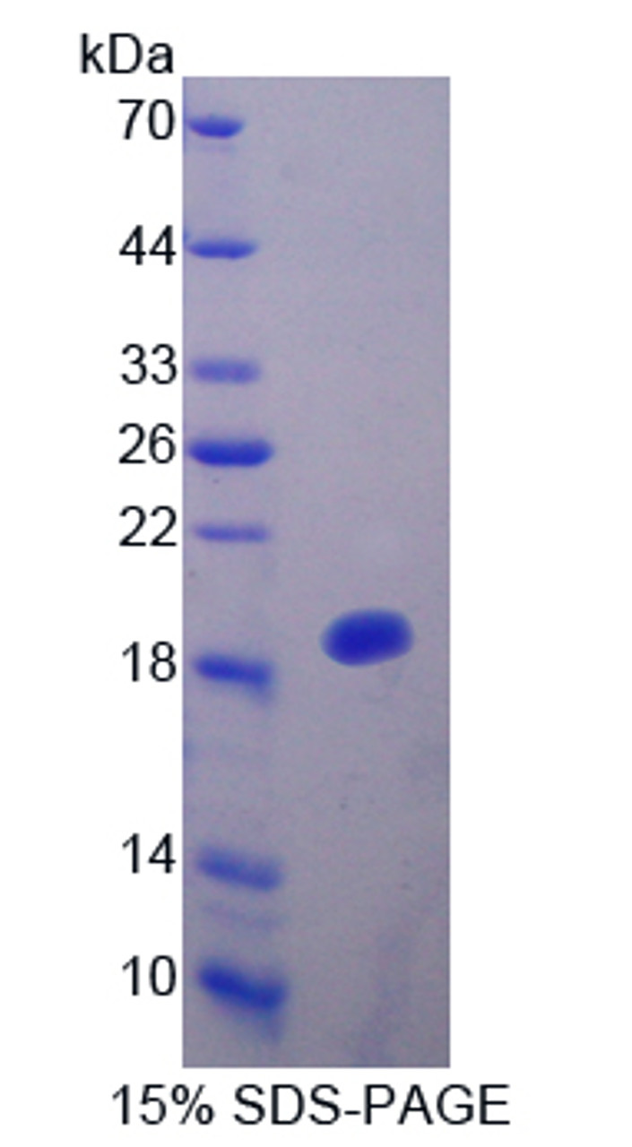 Rat Recombinant Interleukin 25 (IL25)