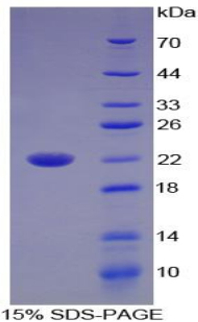 Human Recombinant Interleukin 17B (IL17B)