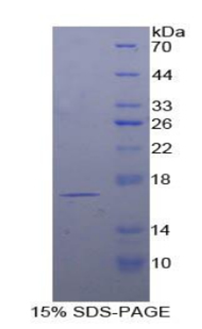 Human Recombinant T-Cell Leukemia/Lymphoma Protein 1A (TCL1A)