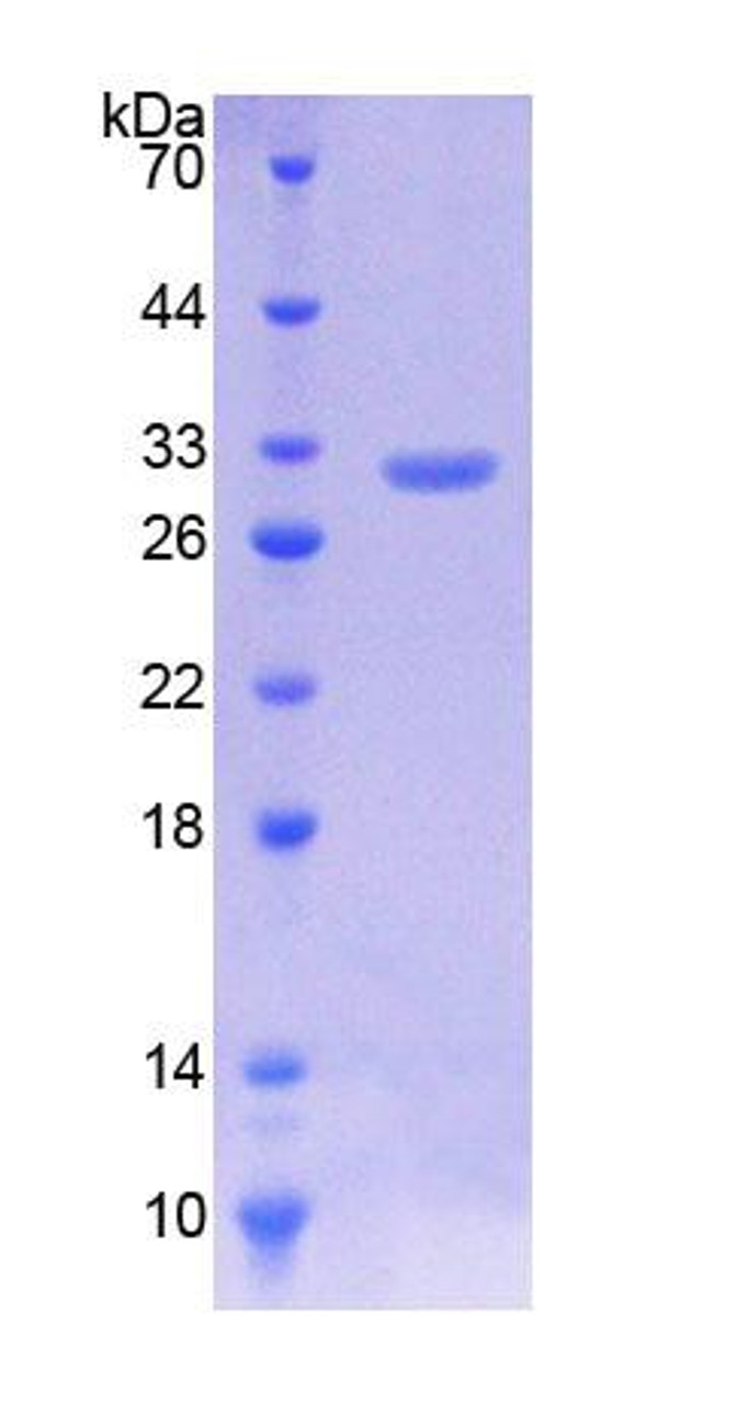 Human Recombinant Kruppel Like Factor 5, Intestinal (KLF5)