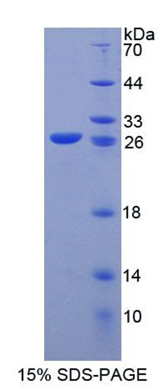 Human Recombinant Kell Protein (KEL)