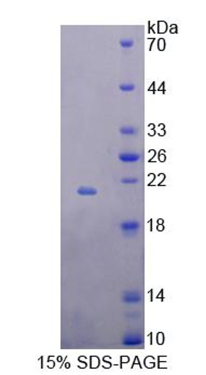 Rat Recombinant B And T-Lymphocyte Attenuator (BTLA)