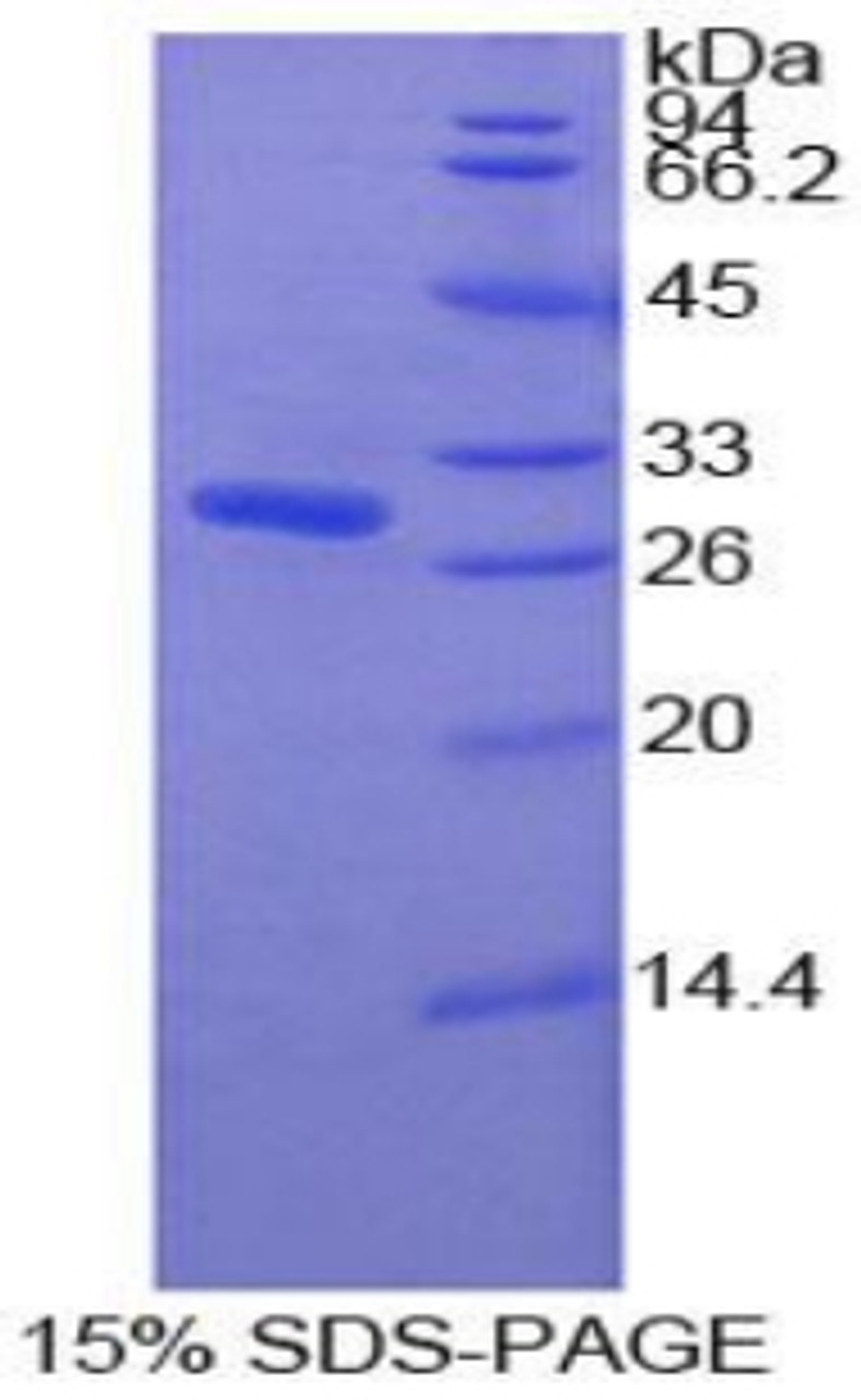 Human Recombinant Pyridoxal Kinase (PDXK)