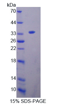 Rat Recombinant Oncoprotein Induced Transcript 3 (OIT3)