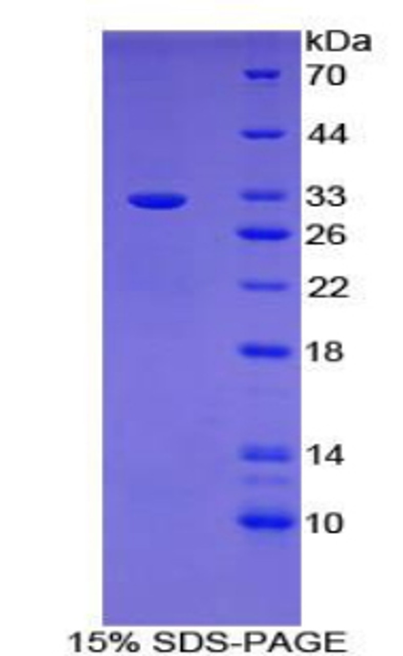 Mouse Recombinant B-Cell CLL/Lymphoma 3 (Bcl3)